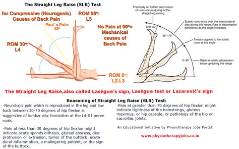 Physiotherapy Jobs The Straight Leg Raise Slr Test