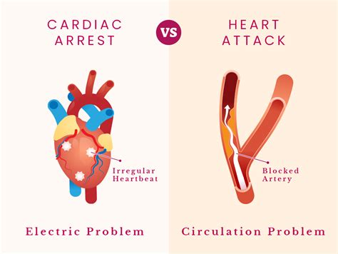 Heart Attack And Cardiac Arrest Understanding The Differences And