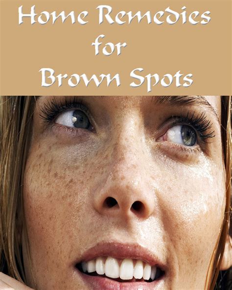 Home Remedies For Brown Spots