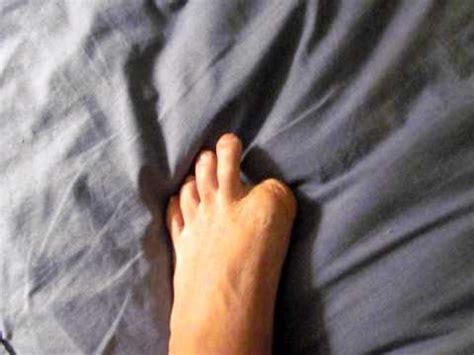 Due to a combination of anatomical factors and the snugness of the fabric covering it, the crotch and pudendal cleft may take on a resemblance to the forefoot of a camel. No Big Toe - YouTube