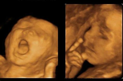 Babies Still In The Womb Like To Party 4d Ultrasounds Show Silly
