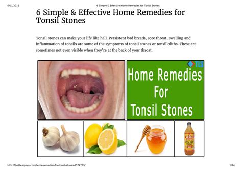 6 Best Home Remedies For Tonsil Stones By Thelifesquare Issuu
