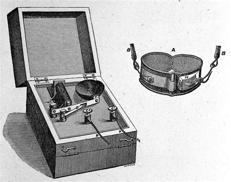 Appliances For Treatment And Prevention Of Male And Female Masturbation From The Victorian Era