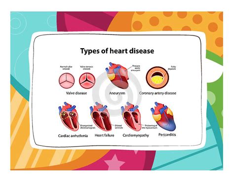 Cvd Types Of Heart Disease Heart Disease Types Of Heart Disease