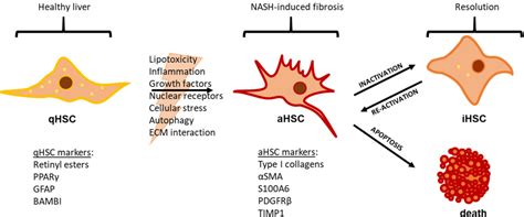 Figure 2 From Hepatic Stellate Cell Activation And Inactivation In Nash