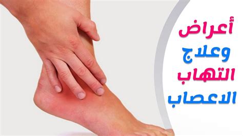 علاج التهاب الأعصاب والعضلات بالأعشا