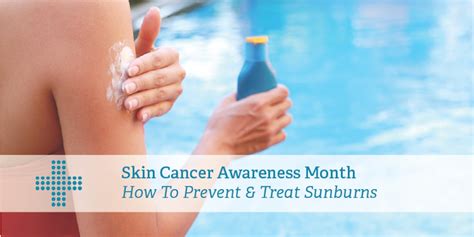 Skin Cancer Awareness Month Sunburns Patient Plus