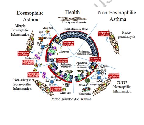 The Heterogeneity Of Asthma Immunopathology Segmented Into Eosinophilic