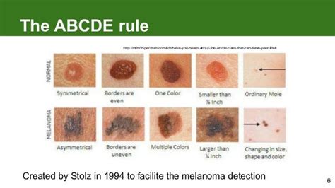 Abcde Of Skin Cancer Pdf Time To Move Forward After The Report Of The
