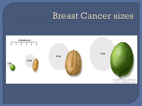 Ppt Breast Cancer Powerpoint Presentation Free Download Id 2347295