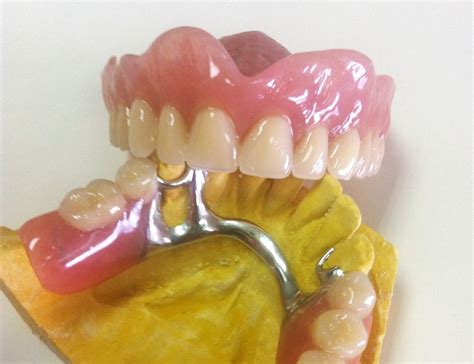 Cómo Cuidar Las Dentaduras Postizas Clínica Dental Larrañaga