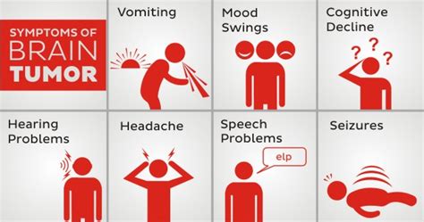 8 Symptoms Of Brain Tumor You Must Know Healthkart