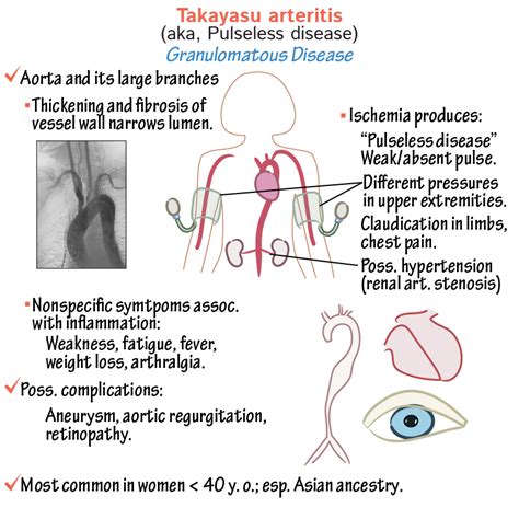 Clinical Pathology Glossary Takayasu Arteritis Ditki Medical