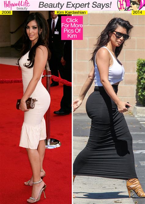 Kim Kardashians Butt Implants 2 Ways She Got ‘paper Magazine Butt — Surgeons Hollywood Life