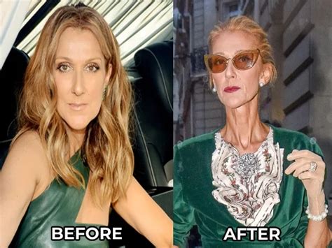 Celine Dion Weight Loss 2021 Health Eating Disorder Truth Revealed