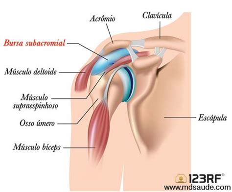 JORNAL PONTO COM BURSITE NO OMBRO Causas Sintomas E Tratamento Dor