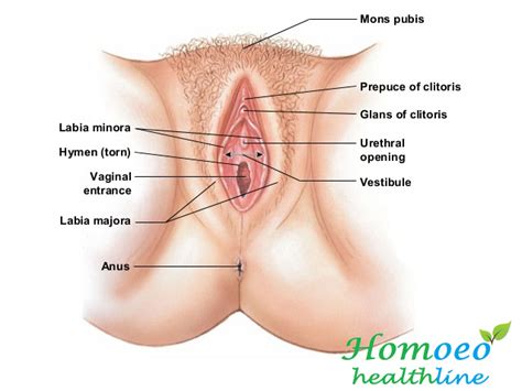 Como se hace un exudado vulvar en casa