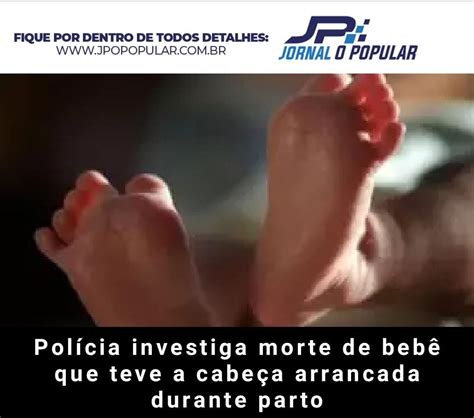 Pol Cia Investiga Morte De Beb Que Teve A Cabe A Arrancada Durante