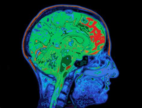 Can Brain Scans Diagnose Adhd Joel T Nigg Phd