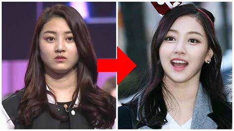 Kpop Idol Plastic Surgery Before And After Pictures