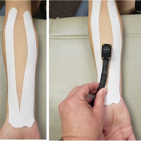 Image Showing Application Of The Kinesio Tape On The Forearm The