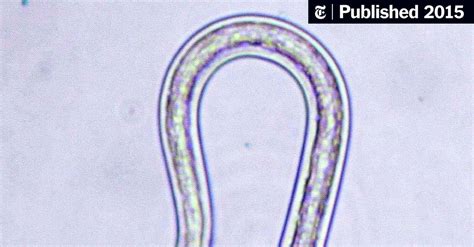 Parasites Found To Influence Fertility In Women The New York Times