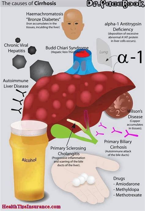 Causes Of Cirrhosis Cirrhosis Nursing Mnemonics Fatty Liver