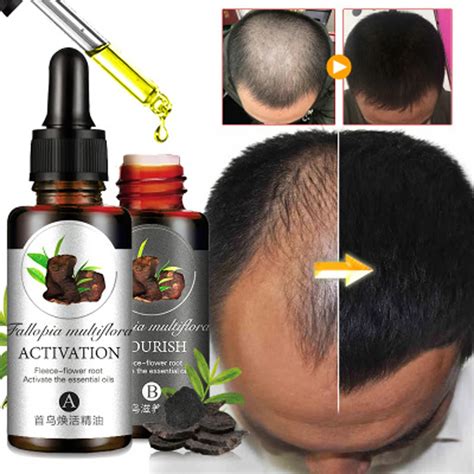 2pcsset Hair Growth Essential Oils Professional Hair Growth Fluid Hair
