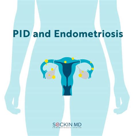 pid and endometriosis seckin endometriosis center