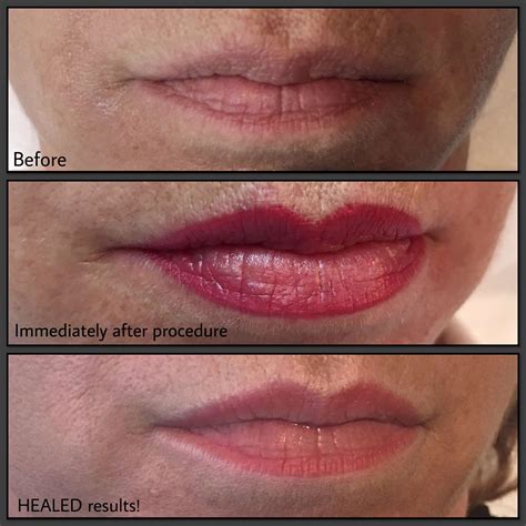 Permanent Makeup Lips Before And After Hair Illusions