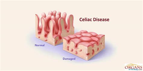 Small Intestine Function Location Parts Diseases And Facts