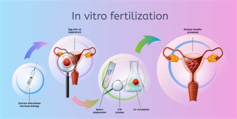 In Vitro Fertilization Ivf Cost Success Rate Details