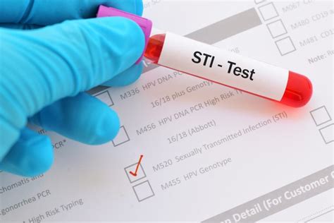 How Doctors Test For Stds Stdgov Blog