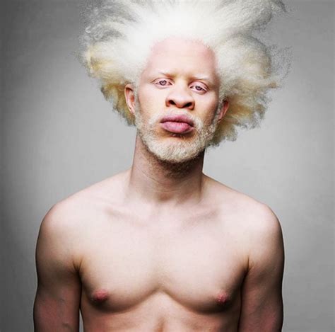 14 Models With Albinism Who Are Taking The Fashion World By Storm Albino Model Unique Faces