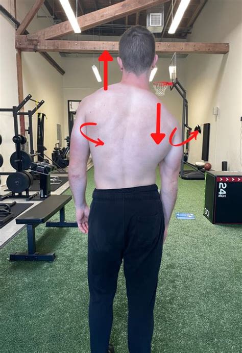 How To Fix Uneven Shoulders Lower Left Vs Right Shoulder Asymmetries