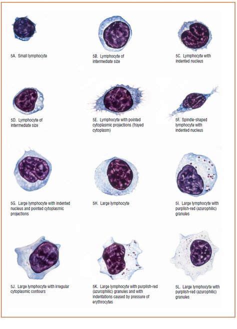 Large And Small Lymphocytes 723×1004 Hematology Medical