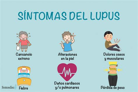 ¿qué Es El Lupus Somosdisc