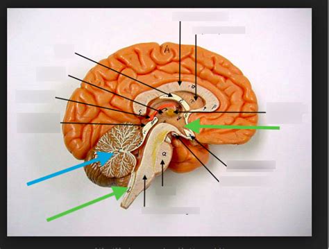 Midsagittal Brain Diagram Quizlet