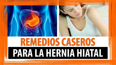 REMEDIOS CASEROS PARA HERNIA DE HIATO REMEDIOS PARA HERNIA HIATAL