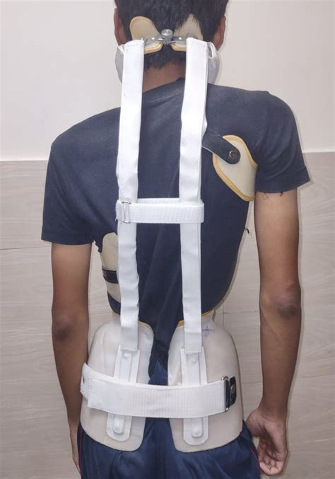 Custom Milwaukee Spinal Brace At Rs 22000piece Spinal Brace In