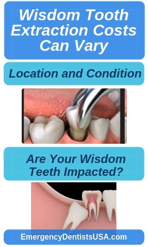 Wisdom Teeth Removal Near Me No Insurance Extractions 247
