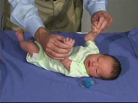 Neurologic Exam Pediatric Newborn Normal Primitive Reflexes Grasp