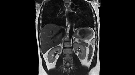 Color Mri Image Abdomen And Spine Anatomy Spine Health Anatomy My XXX