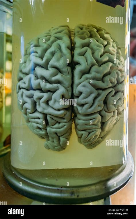 Human Brain In Glass Jar With Formaldehyde For Medical Studies Stock