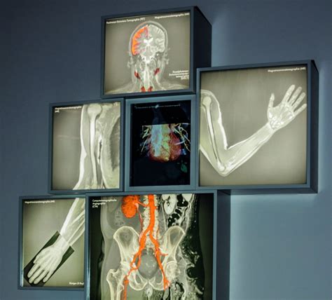 The €32 Billion Diagnostic Imaging Market At A Crossroads • Healthcare