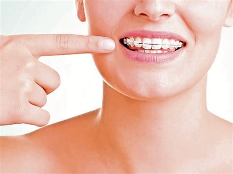 la ortodoncia es mas  una solucion estetica prensa libre