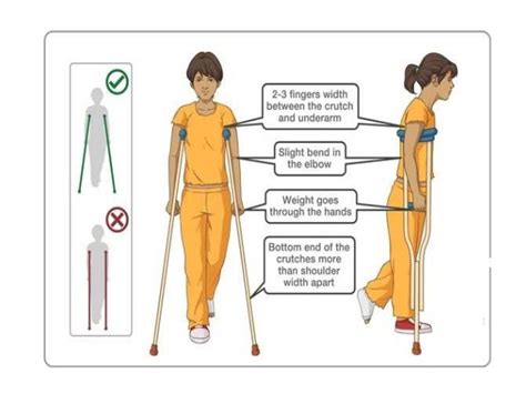Crutch Walking Ortho Theory Notes Dnb Orthopaedics Ms Orthopedics