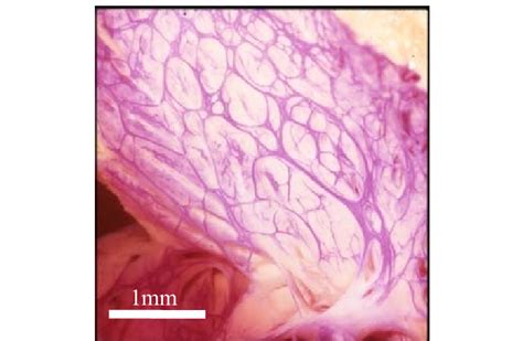 A Photograph Of The Purkinje Fibers Of A Sheep 7 Download