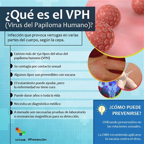 Prevención Conoce los síntomas del VPH en el cuerpo y cómo se