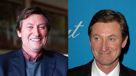 Wayne Gretzkys Plastic Surgery His Secret To Anti Aging